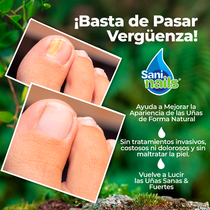 SaniNails Ayuda a Combatir Hongos Uñas